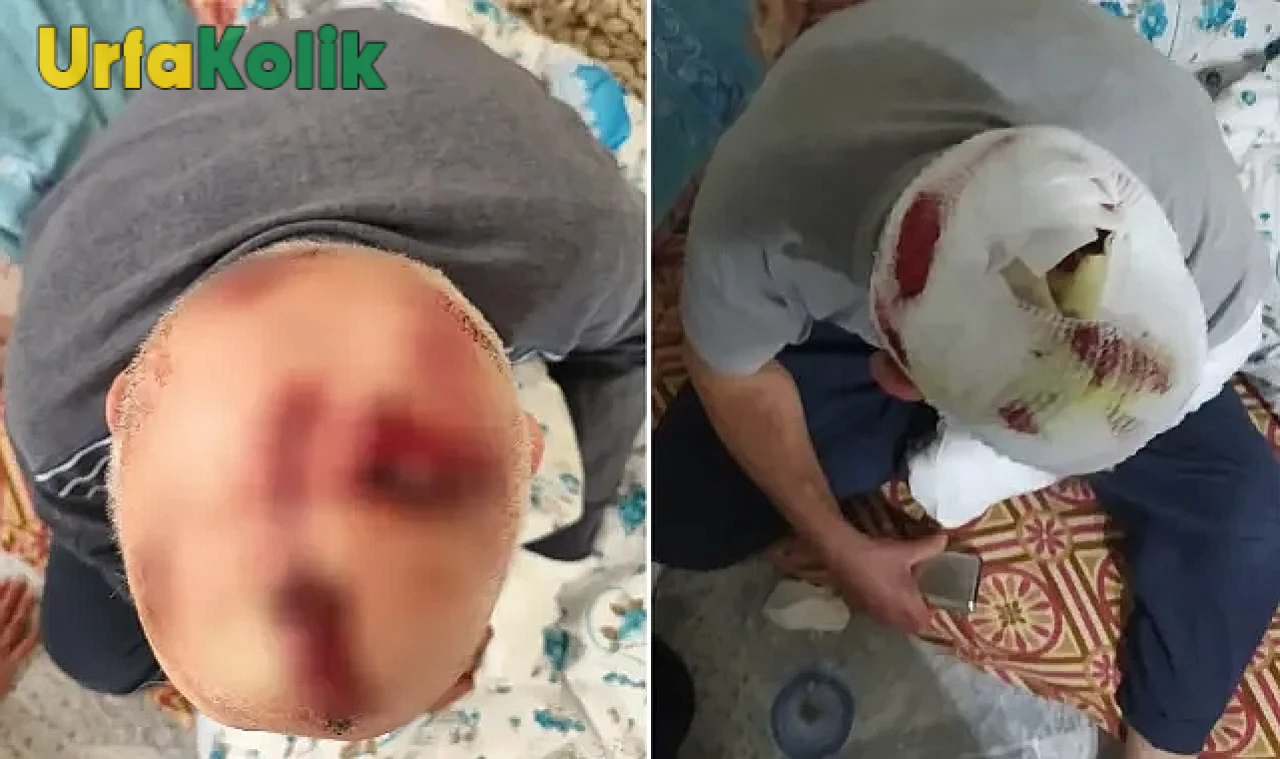 Şanlıurfa'da Boşanma Aşamasındaki Damat, Kayınbabasına Saldırdı: Kafasına Onlarca Dikiş Atıldı.