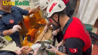 Şanlıurfa'da Dehşet Veren Kaza: Bir Kişinin Koluna 12 Numaralı Demir Parçası Saplandı!