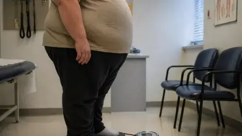 Türkiye’de Obezite Oranı Artıyor: Her 5 Kişiden Biri Obez