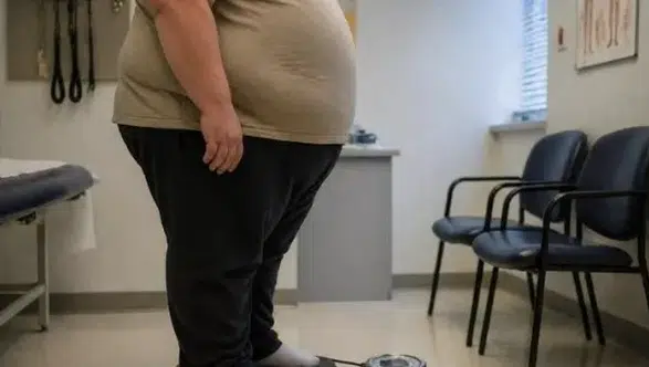 Türkiye’de Obezite Oranı Artıyor: Her 5 Kişiden Biri Obez