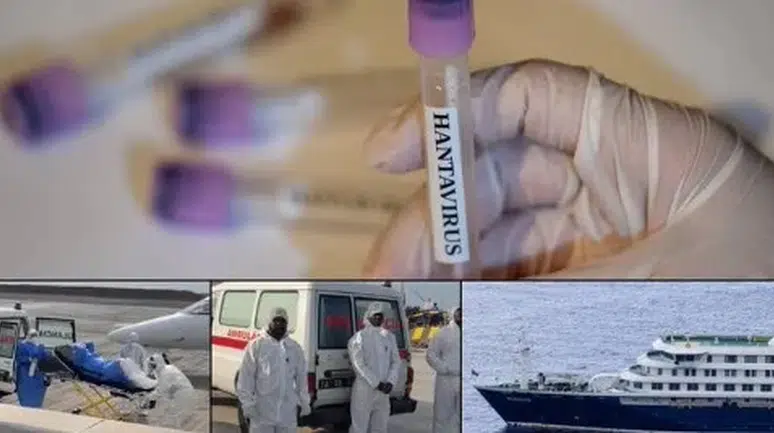 Hantavirüs Alarmı: Temas Eden Kabin Memuru Hastaneye Kaldırıldı